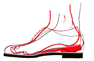 Abbildung: Abrollen im Schuh